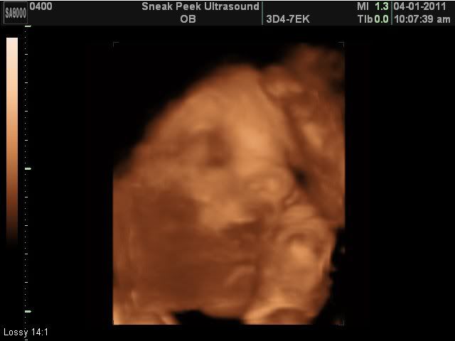 3d ultrasound 20 weeks boy. 20 week ultrasound scheduled